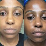 6 Benefits of Vitamin C Serum & How to Use It